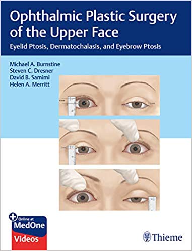 خرید ایبوک Ophthalmic Plastic Surgery of the Upper Face دانلود کتاب جراحی پلاستیک چشم از قسمت فوقانی صورت
