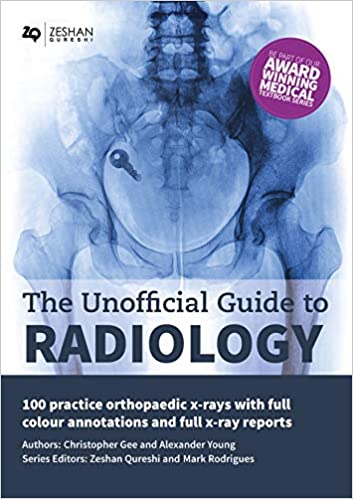 دانلود کتاب The Unofficial Guide Radiology 100 Practice Orthopaedic X Rays with Full Colour Annotations Full دانلود ایبوک راهنمای غیررسمی رادیولوژی 