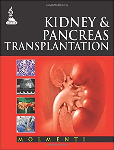 خرید ایبوک Kidney and Pancreas Transplantation دانلود کتاب پیوند کلیه و پانکراس