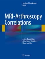 خرید ایبوک MRI-Arthroscopy Correlations A Case-Based Atlas of the Knee دانلود کتاب همبستگی MRI- آرتروسکوپی اطلس زانو 