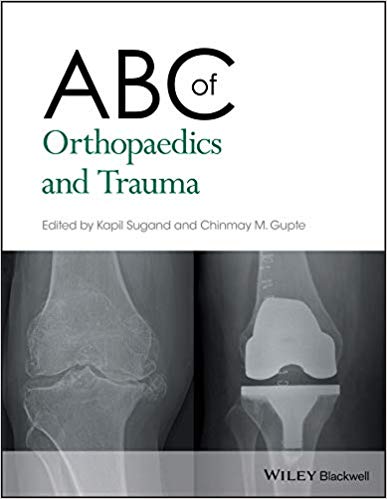 دانلود کتاب ABC of orthopaedics and trauma خرید ایبوک ABC ارتوپدی و تروما