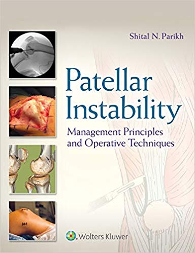 خرید ایبوک Patellar Instability Management Principles and Operative Techniques دانلود کتاب اصول مدیریت بی ثباتی Patellar و تکنیک های عملیاتی