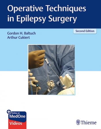 خرید ایبوک Operative Techniques in Epilepsy Surgery دانلود کتاب تکنیک های عمل در جراحی صرع