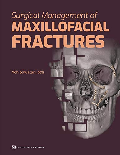 دانلود کتاب Surgical Management of Maxillofacial Fractures خرید کتاب مدیریت جراحی شکستگی های فک و صورت Language: EnglishASIN: B07YF4P2KQ