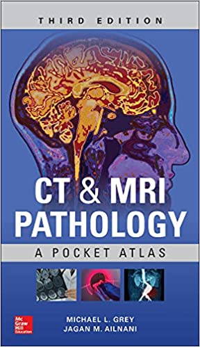 دانلود کتاب CT MRI Pathology A Pocket Atlas 3rd Edition دانلود ایبوک اطلس جیبی پاتولوژی CT و MRI ISBN-10: 1260121941 ISBN-13: 978-1260121940