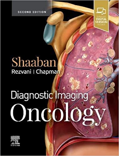 دانلود کتاب Diagnostic Imaging Oncology 2nd Edition دانلود ایبوک تصویربرداری تشخیصی انکولوژی نسخه دوم ISBN-10: 0323661122