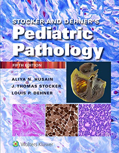 ایبوک Stocker and Dehner's Pediatric Pathology 5th Edition خرید کتاب آسیب شناسی اطفال نسخه پنجم ISBN-13 : 978-1975144814 کتاب آسیب شناسی اطفال استوکر و دهنر، ویرایش پنجم 